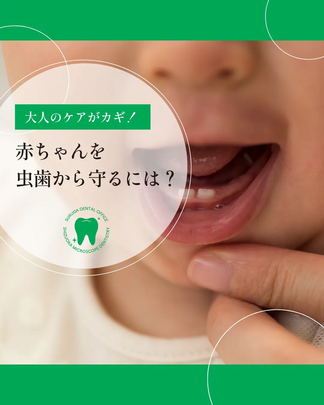 赤ちゃんを虫歯から守るには？